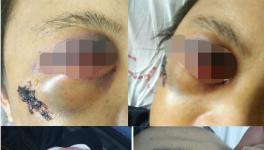 快訊 | 華潤水泥分廠發(fā)生事故?。ǜ綀D）