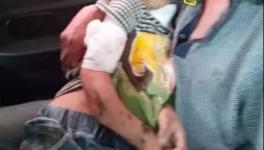 突發(fā)！血肉模糊！混凝土攪拌機(jī)把人活活攪死！